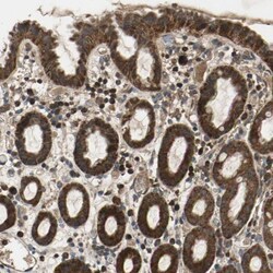 ZNF608 Antibody, Novus Biologicals 25ul | Buy Online | Novus Biologicals | Fisher Scientific